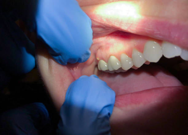 Best Emergency Cosmetic Dentistry in Cutlerville, MI