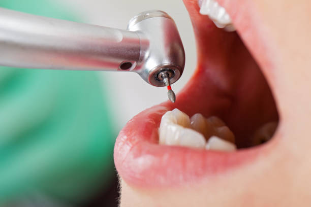 Best Pediatric Emergency Dentist in Cutlerville, MI